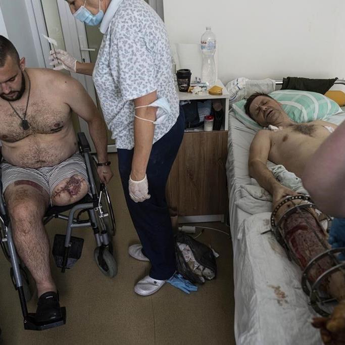 Upward of 20,000 Ukrainian amputees face trauma on a scale unseen since WWI